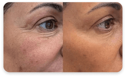 Face Result