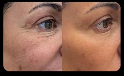Face Result