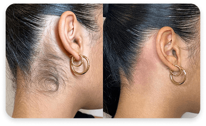 Neck Result