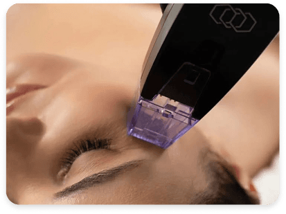 Morpheus8 & RF Treatments